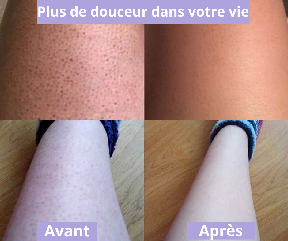 Gomme Magique — Épilation Douce & Peau Soyeuse