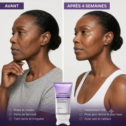 Skin90™ Anti Age Collagene