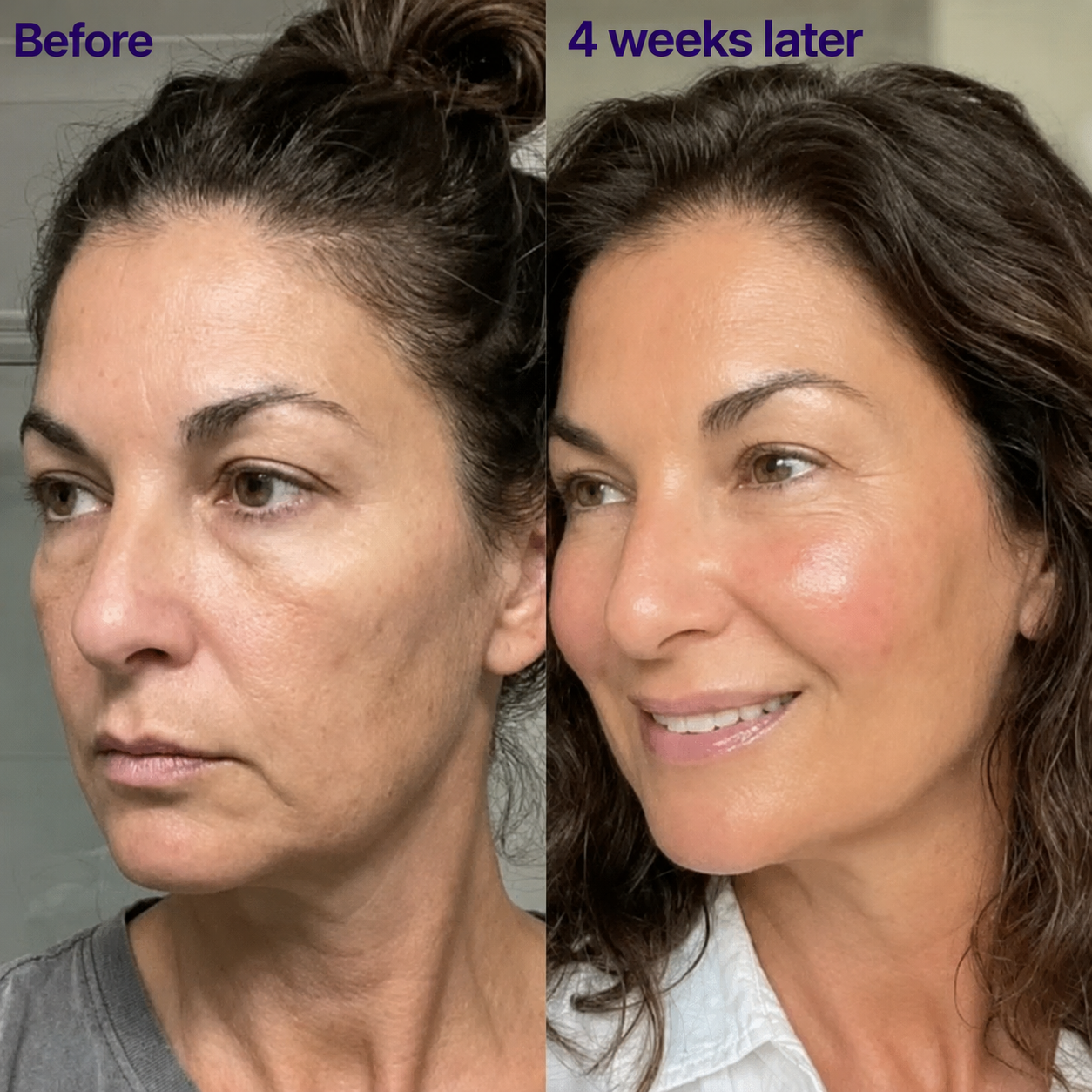 Skin90™ Anti Age Collagene